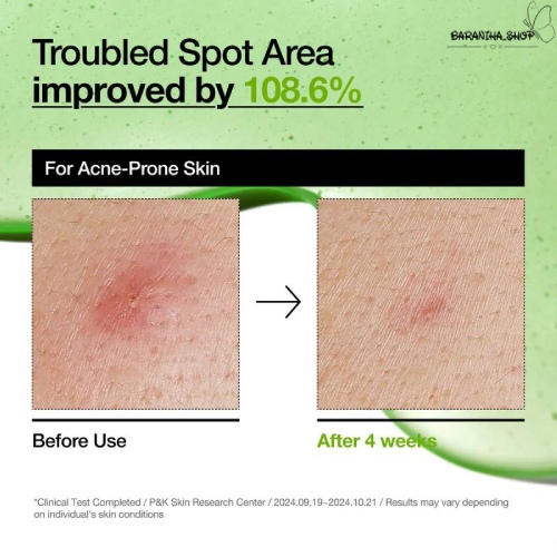 سرم آزلائیک اسید 10% و هیالورون آنوا3 سرم آزلائیک اسید 10% و هیالورون آنوا3
